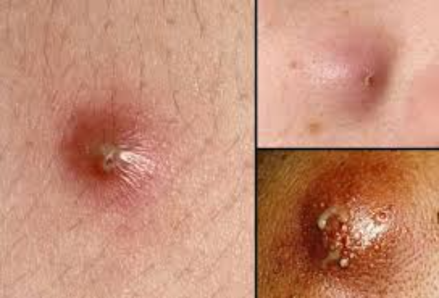Types Skin Diseases that Need to Be Watchful of