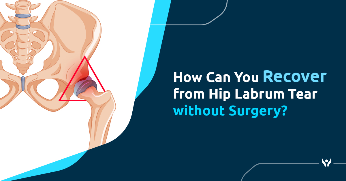 How Can You Recover from Hip Labrum Tear without Surgery?
