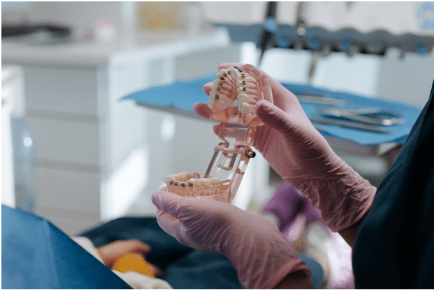 What Are the Advantages of Using Metal Bands on Braces for Correcting Dental?