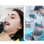 Dental Crown dentist