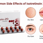 What Are the Common Side Effects of Isotretinoin?